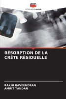 RÉSORPTION DE LA CRÊTE RÉSIDUELLE 6206293297 Book Cover
