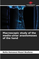 Macroscopic study of the medio-ulnar anastomoses of the hand 6630330404 Book Cover