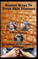 Newest Ways To Treat Skin Diseases: 28 freshest ways of treating skin infections B09SVCG3X8 Book Cover