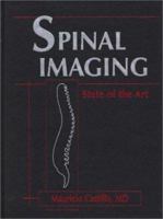 Spinal Imaging: State Of The Art 1560534664 Book Cover