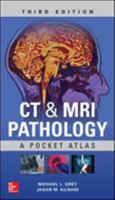 CT & MRI Pathology: A Pocket Atlas 007138040X Book Cover