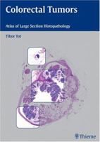 Colorectal Tumors: Atlas of Large Section Histopathology 1588903842 Book Cover