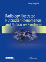 Radiology Illustrated: Nutcracker Phenomenon and Nutcracker Syndrome 9811662177 Book Cover