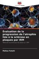 Évaluation de la progression de l'atrophie liée à la sclérose en plaques par IRM (French Edition) 6209843948 Book Cover