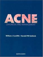 Acne: Diagnosis and Management 1853172065 Book Cover