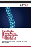 Escoliosis, Hipercifosis, Hiperlordosis, Evaluación y Tratamiento 6202102381 Book Cover