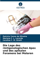 Die Lage des röntgenologischen Apex und des apikalen Foramens bei Molaren (German Edition) 6207849957 Book Cover
