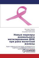 Novye markery anomal'nogo metilirovaniya DNK pri rake molochnoy zhelezy: Identifikatsiya metodom nepredvzyatogo skrininga differentsial'nogo metilirovaniya genomov 3659256994 Book Cover