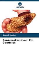 Pankreaskarzinom: Ein Überblick (German Edition) 6207630432 Book Cover