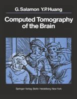 Computed Tomography of the Brain: Atlas of Normal Anatomy 3540088253 Book Cover