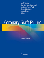 Coronary Graft Failure: State of the Art 331926513X Book Cover