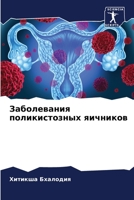 Заболевания поликистозных яичников 6206077721 Book Cover