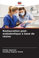 Restauration post-endodontique à base de résine (French Edition) 6207437683 Book Cover