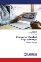 Implantologie assistée par ordinateur (French Edition) 6206153126 Book Cover