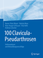 100 Clavicula-Pseudarthrosen: Fehleranalysen Und Behandlungsvorschl�ge 3662553449 Book Cover