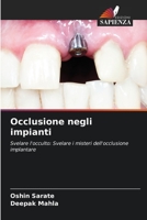Occlusione negli impianti: Svelare l'occulto: Svelare i misteri dell'occlusione implantare 6206119866 Book Cover