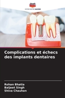 Complications et échecs des implants dentaires (French Edition) 6208232759 Book Cover