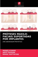 PROTHÈSES MAXILLO-FACIALES SUPPORTÉES PAR DES IMPLANTS: UNE APPROCHE PROTHÉTIQUE 6203402540 Book Cover