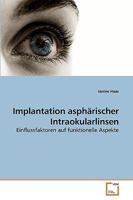 Implantation asphärischer Intraokularlinsen: Einflussfaktoren auf funktionelle Aspekte 363920591X Book Cover