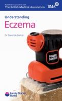 Eczema (Understanding) (Family Doctor Books) 1903474388 Book Cover