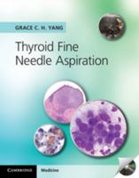Thyroid Fine Needle Aspiration 1107618134 Book Cover