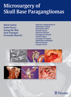 Head and Neck Paragangliomas 3131486112 Book Cover