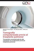 Tomografía computarizada previa al trasplante pulmonar 3847353721 Book Cover