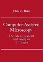 Computer-Assisted Microscopy: The Measurement and Analysis of Images 0306434105 Book Cover