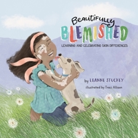 Beautifully Blemished: Learning and Celebrating Skin Differences B0BSY6625M Book Cover