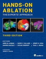 Hands-On Ablation: The Experts' Approach, Third Edition 1942909403 Book Cover