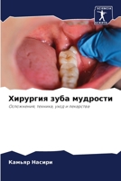Хирургия зуба мудрости: Осложнения, техника, уход и лекарства 6205998084 Book Cover