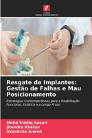 Resgate de Implantes: Gestão de Falhas e Mau Posicionamento (Portuguese Edition) 6630053982 Book Cover
