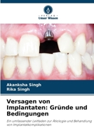 Versagen von Implantaten: Gründe und Bedingungen (German Edition) 6207027906 Book Cover
