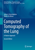 Computed Tomography of the Lung: A Pattern Approach (Medical Radiology / Diagnostic Imaging) 3642395171 Book Cover