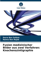 Fusion medizinischer Bilder aus zwei Verfahren: Knochenszintigraphie (German Edition) 6630435451 Book Cover