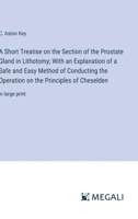 A Short Treatise on the Section of the Prostate Gland in Lithotomy; With an Explanation of a Safe and Easy Method of Conducting the Operation on the Principles of Cheselden: in large print 3368372041 Book Cover