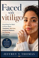 Faced with vitiligo: Everything You Need to Know About Treatment, Skin Care, Emotional Wellness, and Thriving with Vitiligo B0H92PFR8F Book Cover