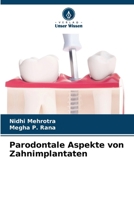 Parodontale Aspekte von Zahnimplantaten (German Edition) 6207544129 Book Cover