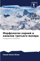 Морфология корней и каналов третьего моляра: В иорданском населении 6202858680 Book Cover