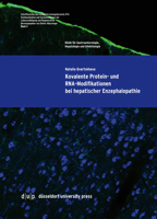 Kovalente Protein- Und Rna-Modifikationen Bei Hepatischer Enzephalopathie 3957580218 Book Cover