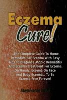 Eczema Cure!: The Complete Guide to Home Remedies for Eczema with Easy Tips to D 1535538325 Book Cover