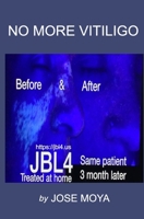 No More Vitiligo B0BYRLLGN2 Book Cover