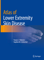 Atlas of Lower Extremity Skin Disease 3031079523 Book Cover
