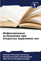 Инфекционные осложнения при открытых переломах ног 6205810263 Book Cover