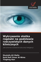 Wykrywanie stozka rogówki na podstawie rzeczywistych danych klinicznych (Polish Edition) 6630115880 Book Cover