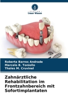 Zahnärztliche Rehabilitation im Frontzahnbereich mit Sofortimplantaten (German Edition) 6207546822 Book Cover