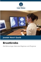 Brustkrebs (German Edition) 6208076552 Book Cover
