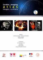 Cardiac Imaging Atlas - Atlas Imagen Cardiaca 8416527695 Book Cover