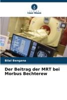 Der Beitrag der MRT bei Morbus Bechterew (German Edition) 6207115589 Book Cover