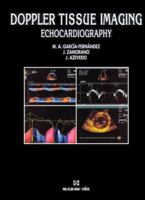 Doppler Tissue Imaging: Echocardiography 8448601874 Book Cover